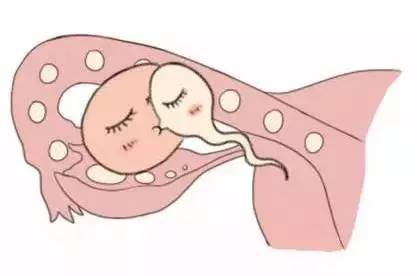 男性不妊